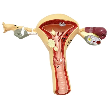 Ľudské Maternice A Vaječníka Model, Ženských Reprodukčných Orgánov Model, Ženských Pohlavných Orgánov, Medicíny, Vyučovacie Anatomické